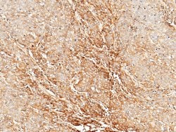 Invitrogen Tetranectin Recombinant Rabbit Monoclonal Antibody (006) 100 &mu;L | Buy Online | Invitrogen&trade; | Fisher Scientific