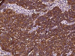 Invitrogen Apolipoprotein J Recombinant Rabbit Monoclonal Antibody (210)