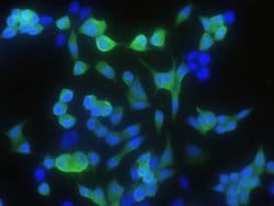 Invitrogen CRABP2 Recombinant Rabbit Monoclonal Antibody (004) 100 &mu;L;