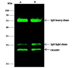 Invitrogen CRABP2 Recombinant Rabbit Monoclonal Antibody (004) 100 &mu;L;