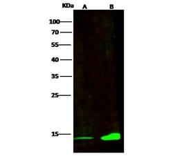 Invitrogen CRABP2 Recombinant Rabbit Monoclonal Antibody (004) 100 &mu;L;