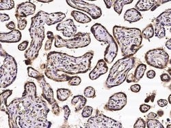 Invitrogen CRIP2 Monoclonal Antibody (05) 100 &mu;L; Unconjugated:Antibodies,