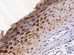 Invitrogen Cystatin A Monoclonal Antibody (01) 100 &mu;L; Unconjugated:Antibodies,