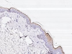 Invitrogen Cystatin A Monoclonal Antibody (01) 100 &mu;L; Unconjugated:Antibodies,