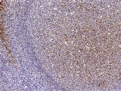 Invitrogen Cystatin A Monoclonal Antibody (01) 100 &mu;L; Unconjugated:Antibodies,