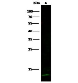 Invitrogen Cystatin A Recombinant Rabbit Monoclonal Antibody (236) 100