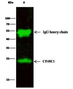 Invitrogen CTHRC1 Recombinant Rabbit Monoclonal Antibody (166) 100 &mu;L;