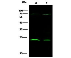 Invitrogen CTHRC1 Recombinant Rabbit Monoclonal Antibody (166) 100 &mu;L;