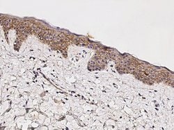 Invitrogen beta Catenin Recombinant Rabbit Monoclonal Antibody (021) 100