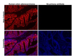Invitrogen beta Catenin Recombinant Rabbit Monoclonal Antibody (021) 100