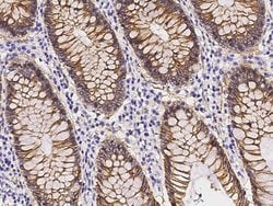 Invitrogen beta Catenin Recombinant Rabbit Monoclonal Antibody (021) 100