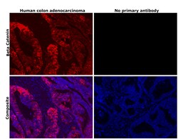 Invitrogen beta Catenin Recombinant Rabbit Monoclonal Antibody (021) 100