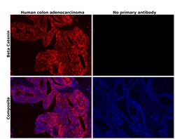 Invitrogen beta Catenin Recombinant Rabbit Monoclonal Antibody (021) 100