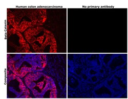 Invitrogen beta Catenin Recombinant Rabbit Monoclonal Antibody (021) 100