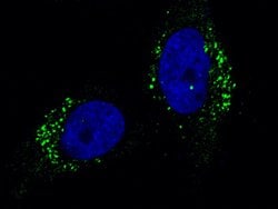 Invitrogen Cathepsin A Recombinant Rabbit Monoclonal Antibody (104) 100