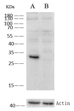 Invitrogen Cathepsin D Recombinant Rabbit Monoclonal Antibody (010) 100