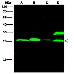 Invitrogen Cathepsin L Recombinant Rabbit Monoclonal Antibody (221) 100 &mu;L | Buy Online | Invitrogen&trade; | Fisher Scientific