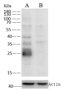 Invitrogen Cathepsin L Recombinant Rabbit Monoclonal Antibody (221) 100 &mu;L | Buy Online | Invitrogen&trade; | Fisher Scientific