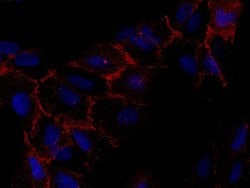 Invitrogen CAR Recombinant Rabbit Monoclonal Antibody (271) 100 &mu;L;