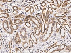 Invitrogen CXCL11 Monoclonal Antibody (08) 100 &mu;L; Unconjugated:Antibodies,