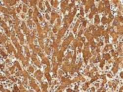 Invitrogen CXCL11 Monoclonal Antibody (08) 100 &mu;L; Unconjugated:Antibodies,