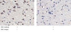Invitrogen DOPA Decarboxylase Recombinant Rabbit Monoclonal Antibody (005) 100 &mu;L | Buy Online | Invitrogen&trade; | Fisher Scientific