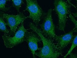 DIABLO Recombinant Rabbit Monoclonal Antibody (006):Antibodies, Recombinant