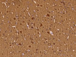 Invitrogen NSE Monoclonal Antibody (14) 100 &mu;L; Unconjugated:Antibodies,