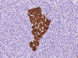 Invitrogen NSE Monoclonal Antibody (14) 100 &mu;L; Unconjugated:Antibodies,