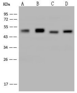 Invitrogen NSE Monoclonal Antibody (14) 100 &mu;L; Unconjugated:Antibodies,