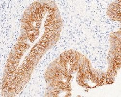 Invitrogen EpCAM Recombinant Rabbit Monoclonal Antibody (28) 100 &mu;L;