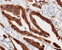 Invitrogen EpCAM Recombinant Rabbit Monoclonal Antibody (28) 100 &mu;L;