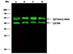 Invitrogen EpCAM Recombinant Rabbit Monoclonal Antibody (28) 100 &mu;L;