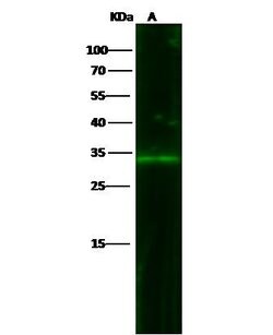 Invitrogen EpCAM Recombinant Rabbit Monoclonal Antibody (28) 100 &mu;L;
