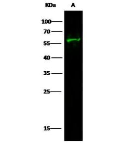 Invitrogen EpoR Recombinant Rabbit Monoclonal Antibody (016) 100 &mu;L;