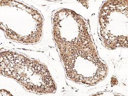 Invitrogen DSPG3 Monoclonal Antibody (03) 100 &mu;L; Unconjugated:Antibodies,
