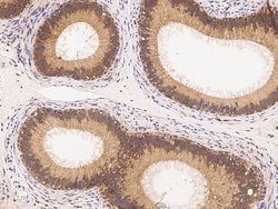 Invitrogen IRE1 alpha Monoclonal Antibody (10B2B2) 100 &mu;L; Unconjugated:Antibodies,