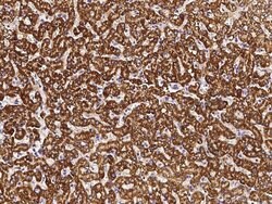 Invitrogen IRE1 alpha Monoclonal Antibody (10B2B2) 100 &mu;L; Unconjugated:Antibodies,