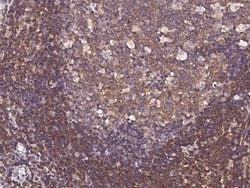 Invitrogen IRE1 alpha Monoclonal Antibody (10B2B2) 100 &mu;L; Unconjugated:Antibodies,