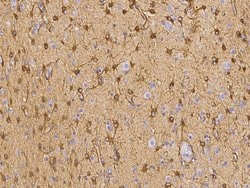 Invitrogen Ezrin Recombinant Rabbit Monoclonal Antibody (037) 100 &mu;L;