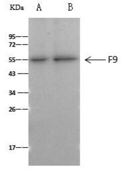 Invitrogen Factor IX Recombinant Rabbit Monoclonal Antibody (034) 100 &mu;L;