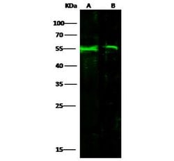 Invitrogen Factor IX Recombinant Rabbit Monoclonal Antibody (034) 100 &mu;L;