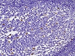 FABP4 Recombinant Rabbit Monoclonal Antibody (001):Antibodies, Recombinant