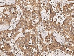 Invitrogen FGFR3 Monoclonal Antibody (07) 100 &mu;L; Unconjugated:Antibodies,