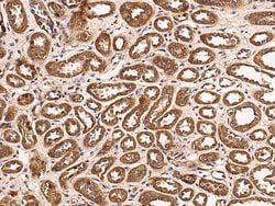 Invitrogen FGFR3 Monoclonal Antibody (07) 100 &mu;L; Unconjugated:Antibodies,