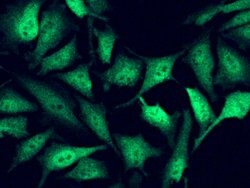 Invitrogen FHIT Recombinant Rabbit Monoclonal Antibody (104) 100 &mu;L;