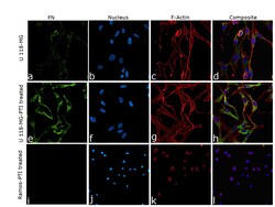 Invitrogen Fibronectin Recombinant Rabbit Monoclonal Antibody (014) 100 &mu;L | Buy Online | Invitrogen&trade; | Fisher Scientific