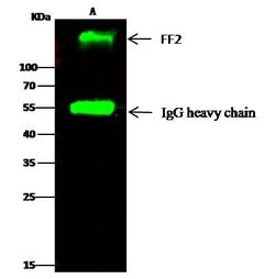 Invitrogen Fibronectin Recombinant Rabbit Monoclonal Antibody (014) 100 &mu;L | Buy Online | Invitrogen&trade; | Fisher Scientific