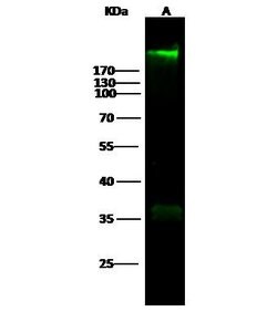 Invitrogen Fibronectin Recombinant Rabbit Monoclonal Antibody (014) 100 &mu;L | Buy Online | Invitrogen&trade; | Fisher Scientific
