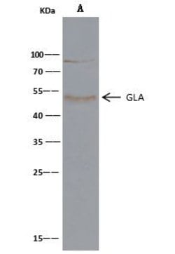 Invitrogen alpha Galactosidase Recombinant Rabbit Monoclonal Antibody (001)